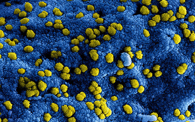 coronavirus-deathcareindustry